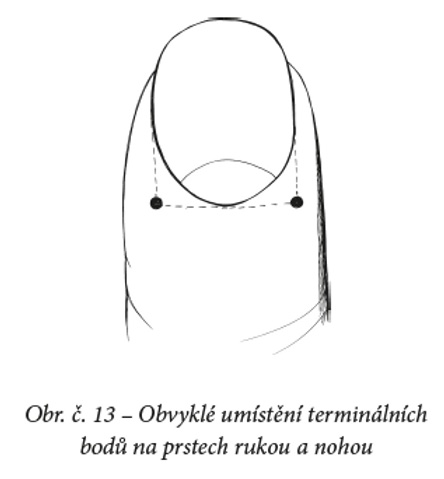 Meridinov mas 